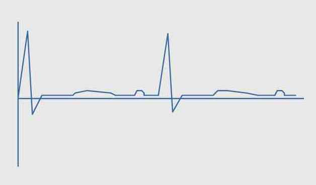 Mehr über den Artikel erfahren Diagnostische Signalverarbeitung in der Humanmedizin